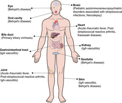 Streptococcal infection and autoimmune diseases